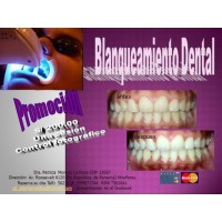 BLANQUEAMIENTO DENTALES